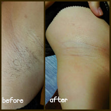 Load image into Gallery viewer, SHR Underarm Super Hair Removal (Trial) - MEROSKIN