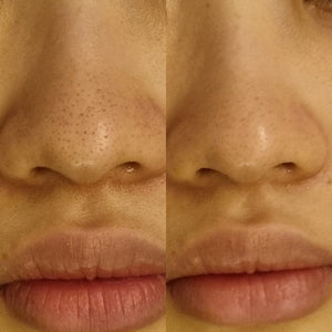 Vitalizing Facial (90mins, Trial) - MEROSKIN