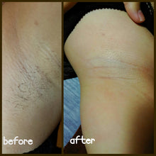 将图片加载到图库查看器，SHR Underarm Super Hair Removal (Trial) - MEROSKIN